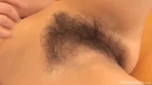 Hairy beauty  1952226