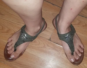 My piggy&#039;s gorgeous feet. 2723017