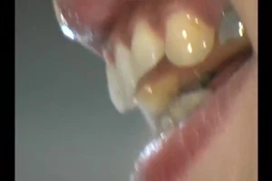 Candid Japanese teeth up close