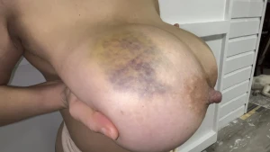 Bruised tits 4223796