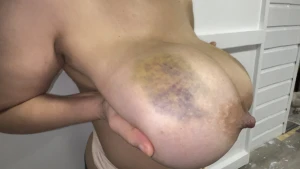 Bruised tits 4223800