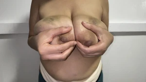 Bruised tits 4223804